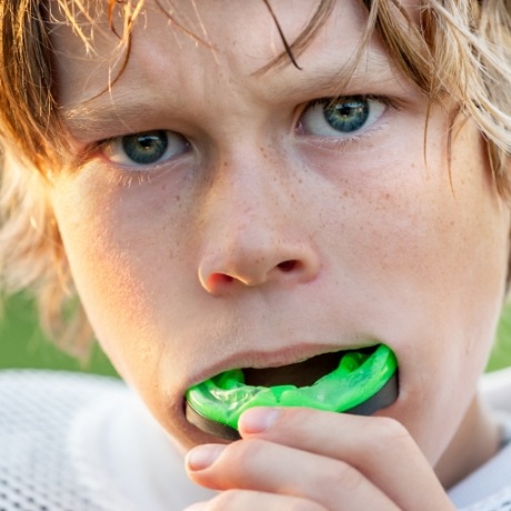 Young boy placing green mouthguard over his teeth