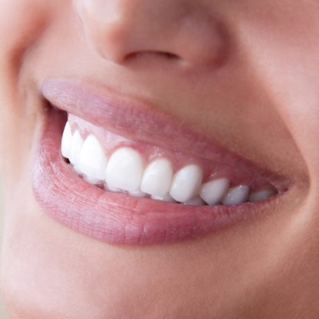 Close up of flawless smile with straight white teeth