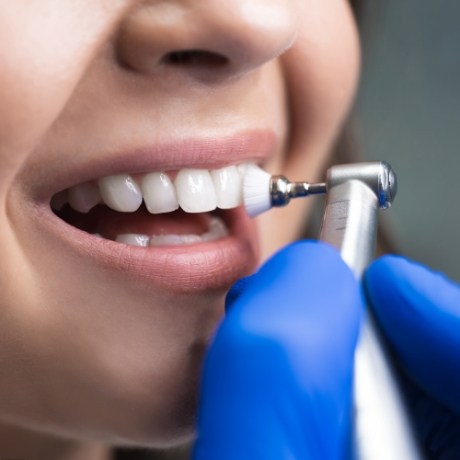 Close up of person receiving a professional dental cleaning in Corinth