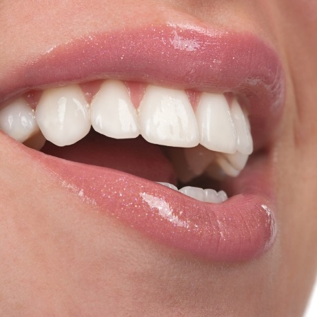 Close up of mouth with flawless white teeth