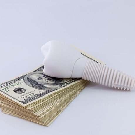 Dental implant model resting on top of money
